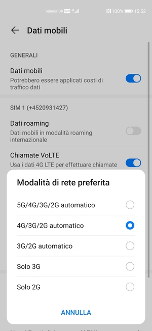 Seleziona la tua opzione preferita